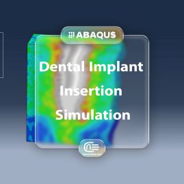 Workshop: Simulation Dental Implant Insertion In Abaqus